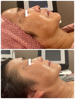 エミュ(e'mu)/40代50代必見!エイジング