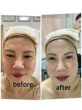 レイ(Lei)/当店のビフォーアフター