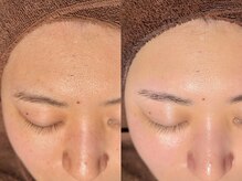 ルーナジェーナ(Luna llena)/池袋　エステ　ルーナジェーナ