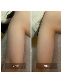 プルトア/大人気AYA METHOD！