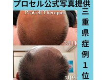 スリール(sourire)の雰囲気（三重県プロセル施術数No1/圧倒的な症例数☆プロセル業界最安）