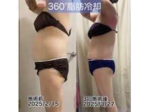 シュシュ(CHUCHU)の雰囲気（効果実感とても早い）