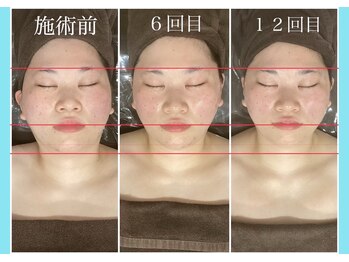 千歳の女神 三河安城店/【施術風景】Before/After