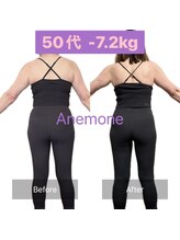 アネモネ/ダイエット/痩身/耳つぼ/腸活