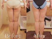 誰でもすぐ結果が出る秘訣は骨格と足裏から整える個別プログラム