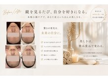 ベアール(beal)の雰囲気（大人気の本格小顔ケア♪むくみ/左右差/凝り解消！クーポンcheck）