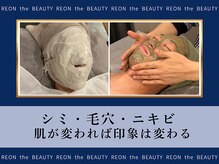 レオンザビューティー(REON the BEAUTY)の雰囲気（エステが初めての男性から大好評！あらゆる肌トラブルに対応）