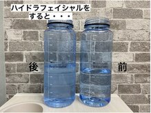 オアシス 藤が丘店(OASIS)/☆施術比較写真☆毛穴洗浄