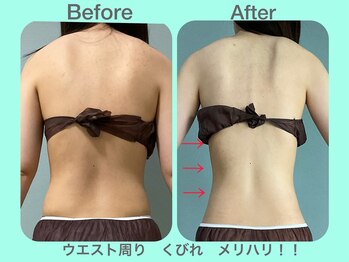 ビーナイス ビューティー(Be Nice Beauty)/腰周り☆ほっそりウエストをGET