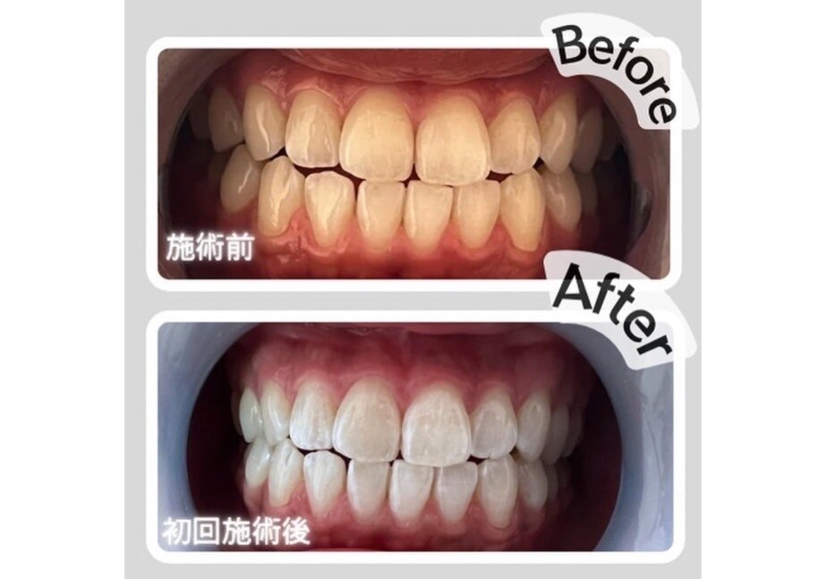 ザ ホワイト(THE WHITE)｜ホットペッパービューティー