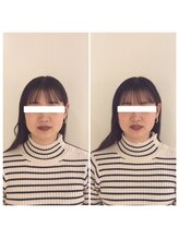 癒し～ぷ 熊本店/小顔矯正も人気【小顔矯正】