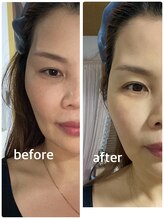 レイ(Lei)/当店のビフォーアフター