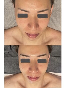 ビーメイクス(B・Makes)/ララピール