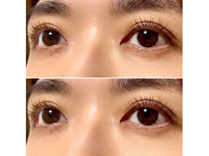 イムル(imulu)の写真