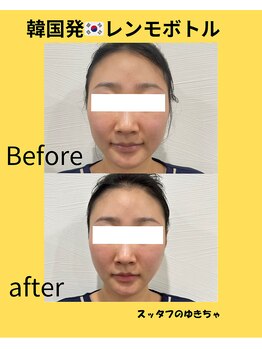 ミツレイ 九条店(MITUREI)/韓国発☆レモンボトル