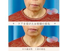 筋膜を引上げて首の長さも復活♪当店だけの技術☆詳細はブログで