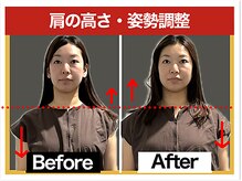 エレヴィザ トウキョウ 恵比寿院(ELVISA TOKYO)/肩の高さ・姿勢のお悩み 