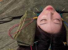 やなけん 亀戸店/美容鍼灸/小顔/毛穴/ヘッドスパ