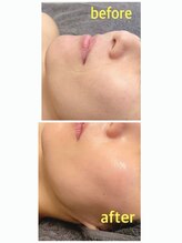 レリ(Reri)/フェイシャル９０分/