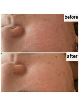 メナードフェイシャルサロン 岐阜茜部/お疲れ肌にダブルビタQパック