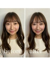 トータルビューティーサロン カノン(Kanon)/【自分史上最高の小顔へ】