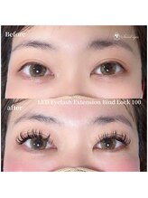 スウィートアイズ(Sweet eyes)/LEDバインドロック 100本