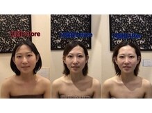アジール 長岡リバーサイド千秋店(agir)/before/after画像
