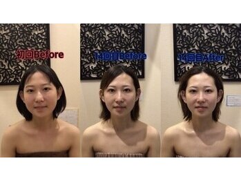 アジール 長岡リバーサイド千秋店(agir)/before/after画像