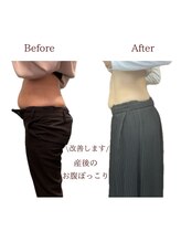 整体院トトノエル 西川原院/Before→After 