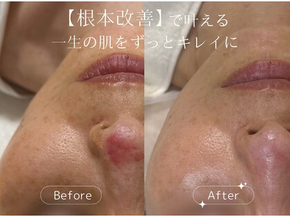 クリエ(Clie)の写真
