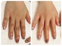 キレイテ 福岡天神店/明るくしっとりとした手肌に