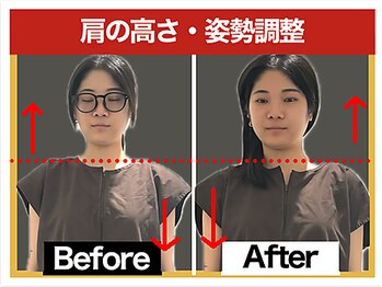 エレヴィザ トウキョウ 恵比寿院(ELVISA TOKYO)/肩の高さ・姿勢のお悩み