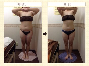 エステティックサロン ピュール ボーテ 東金店/ＢＳＰダイエット