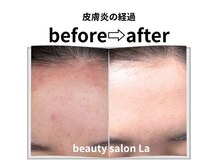 細胞論に沿ったケアによる皮膚改善