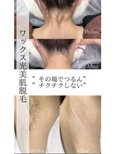 プアマヌ(PUA MANU)/ワックスと光のダブル脱毛