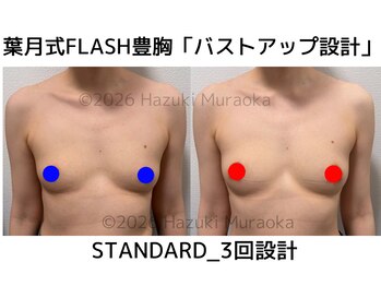 セブンシーズ 上野店(Seven Seas)/バストアップ/豊胸/東京都/上野