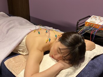 シー バイ カリスタ 新宿駅前店(C by CALISTA)/背中の鍼で肩こりもすっきり