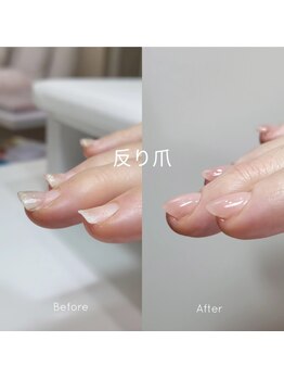 ミンスネイル(Mins Nail)/