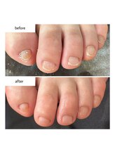 ケアプラス(care plus)/フットネイルケア