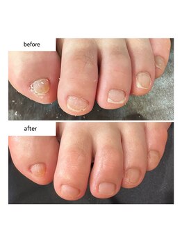 ケアプラス(care plus)/フットネイルケア