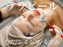 美容鍼灸サロン ユールーム(YOUROOM)の雰囲気（ララピールで肌質改善(肌荒れ/くすみ/毛穴/エイジングケア)☆）