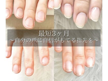 レア(le'a)の写真