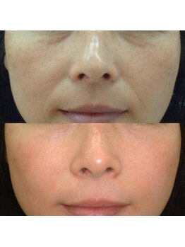 シャルル ストア 京都三条通(Chaleureux Store)/エイジング肌改善