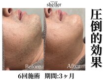 シェリエ(Sheller)