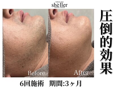 シェリエ(Sheller)の写真