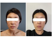 インディバサロン テスタ(testa)/before & after