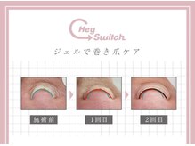 見た目は透明♪重度の方にも◎韓国特許取得の最先端の巻き爪ケア