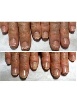 爪の悩みを解消できる（ケア含む）