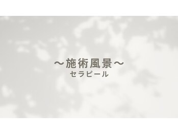 ビー(Be.)/セラピール施術風景