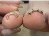 【巻き爪さん必見！】☆足の巻き爪矯正☆1箇所5500円
